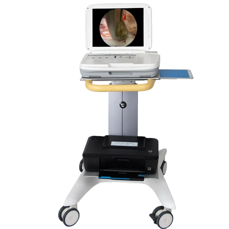 Système d'endoscopie portable  - Medical Lab Images avis et prix